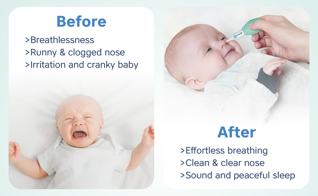Hopop Anti-Reflux Baby Nose Cleaner Gentle & Safe Nasal Aspirator Blue