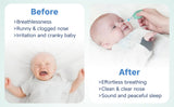 Hopop Anti-Reflux Baby Nose Cleaner Gentle & Safe Nasal Aspirator Blue
