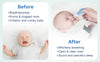 Hopo Nasal Aspirator - Blue