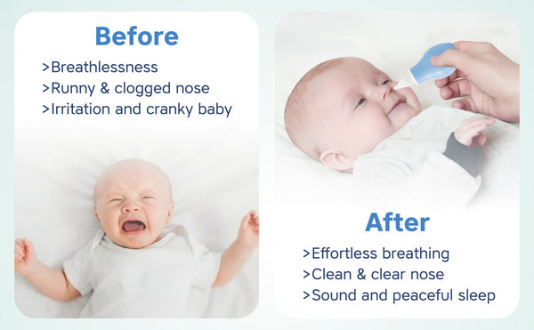 Hopo Nasal Aspirator - Blue